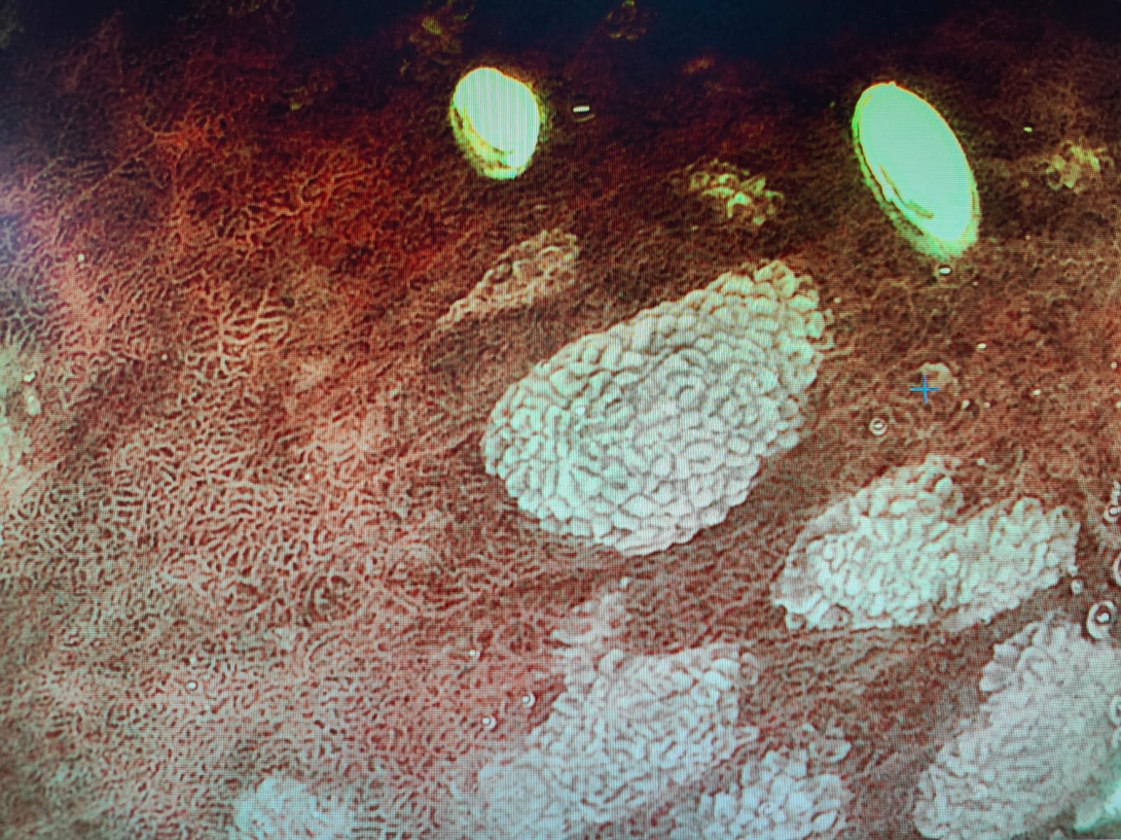Mucosal Pattern Endoscopy.in